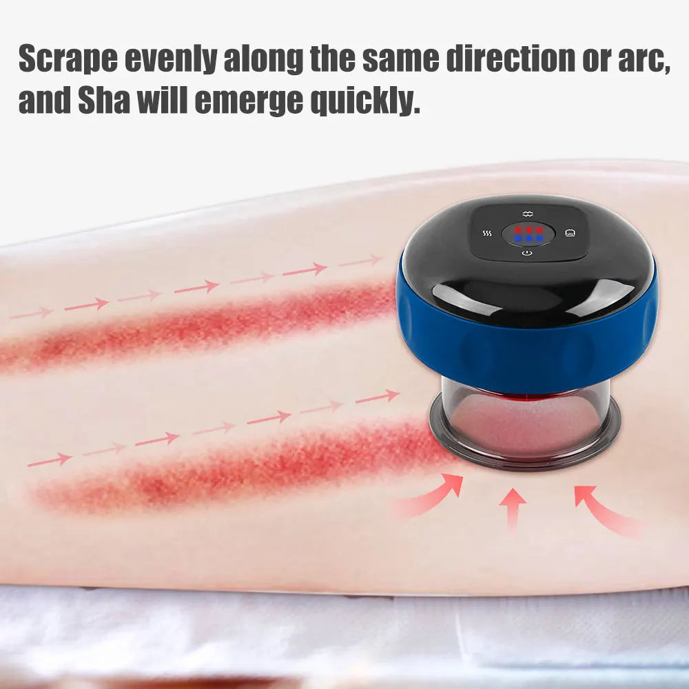 Energy Chi Ping Vacuum Aste by USB, Anti-Cellulite Magnetic Therapy